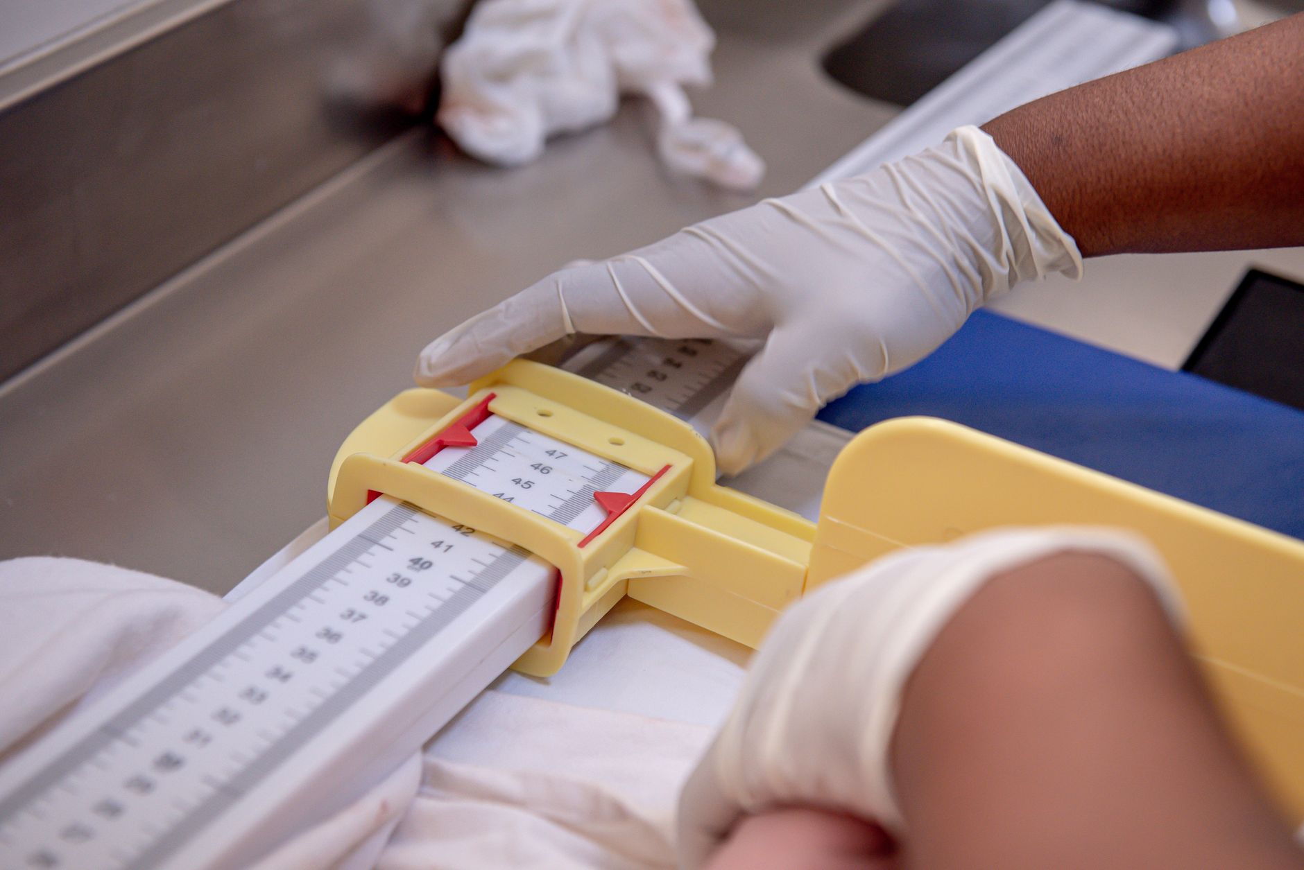 Close-up of a measuring device being used in a PICU setting.