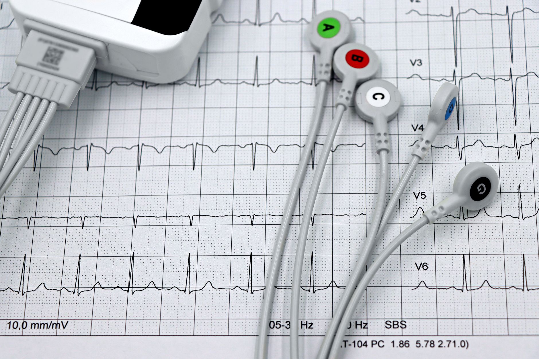 A cardiac technician sets up an ECG machine with electrodes on graph paper in a Turkish clinic.