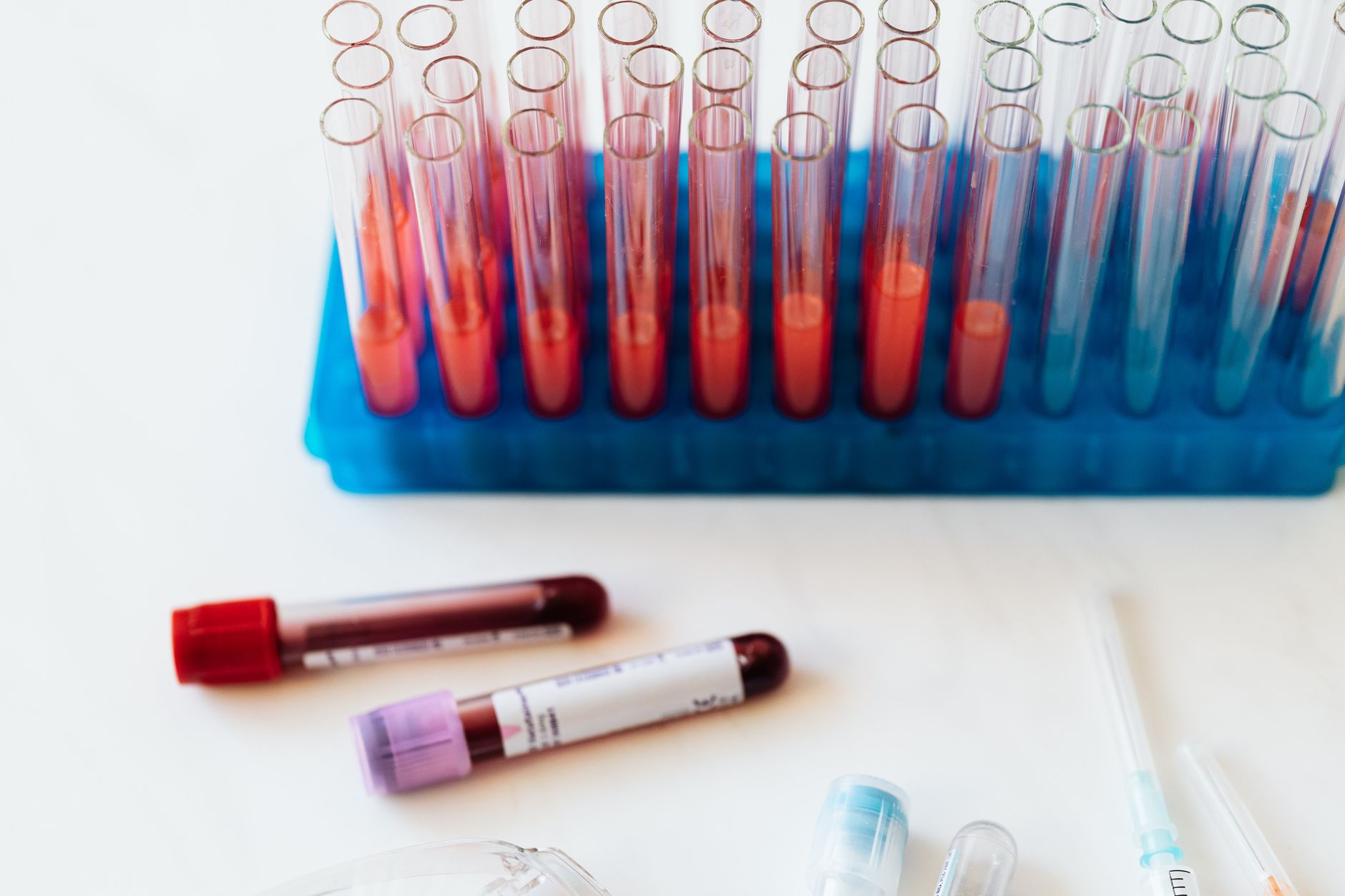 Test tubes filled with red liquid in a lab, representing immunology tests.