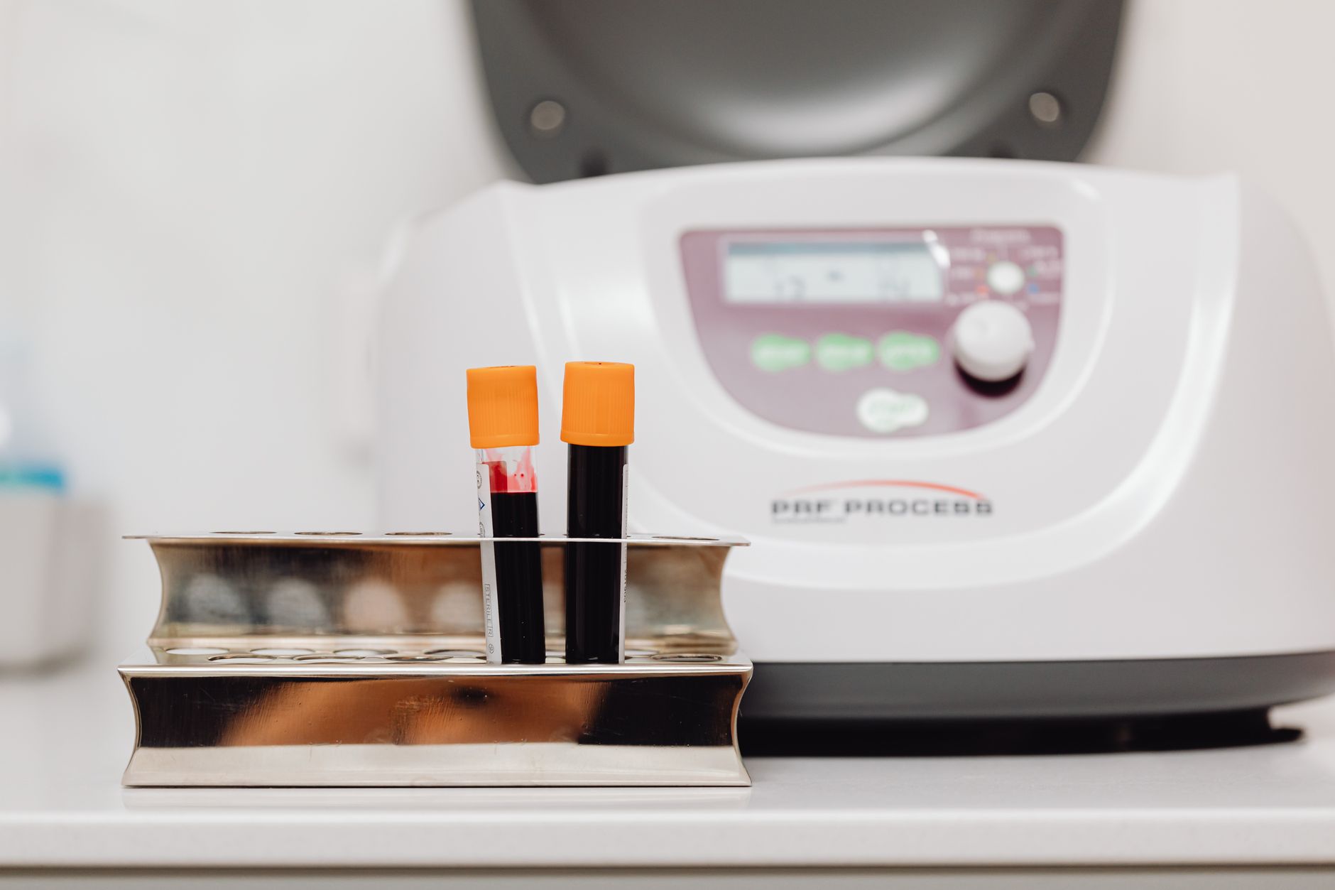 Blood samples in orange-capped tubes next to a centrifuge in a clinical setting.