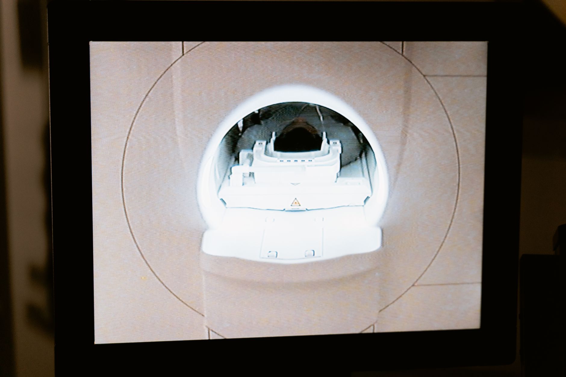 Close-up view of an MRI machine's opening in a Turkish hospital.