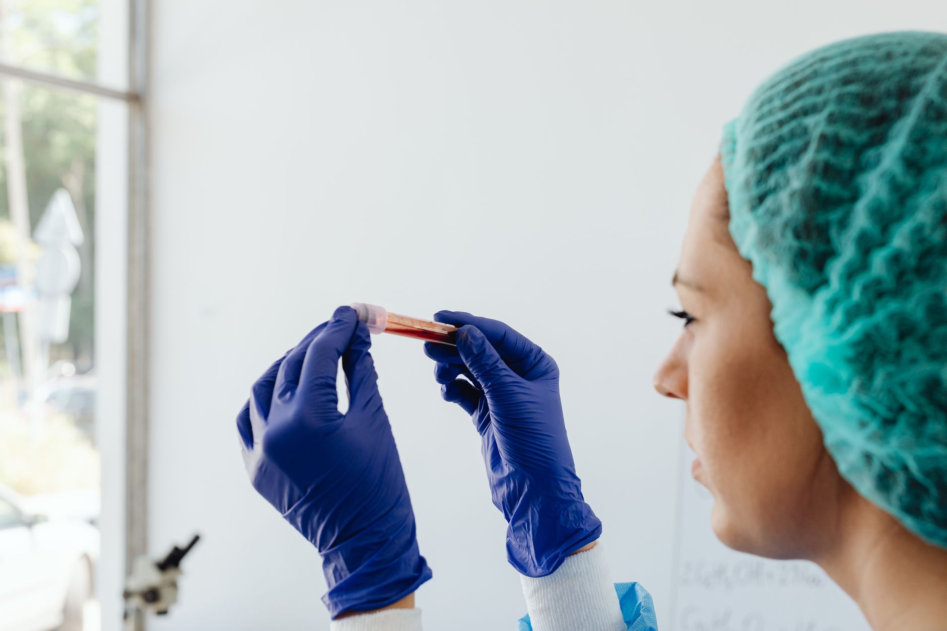 A technician in a Turkish hospital examines a blood sample in a lab setting.