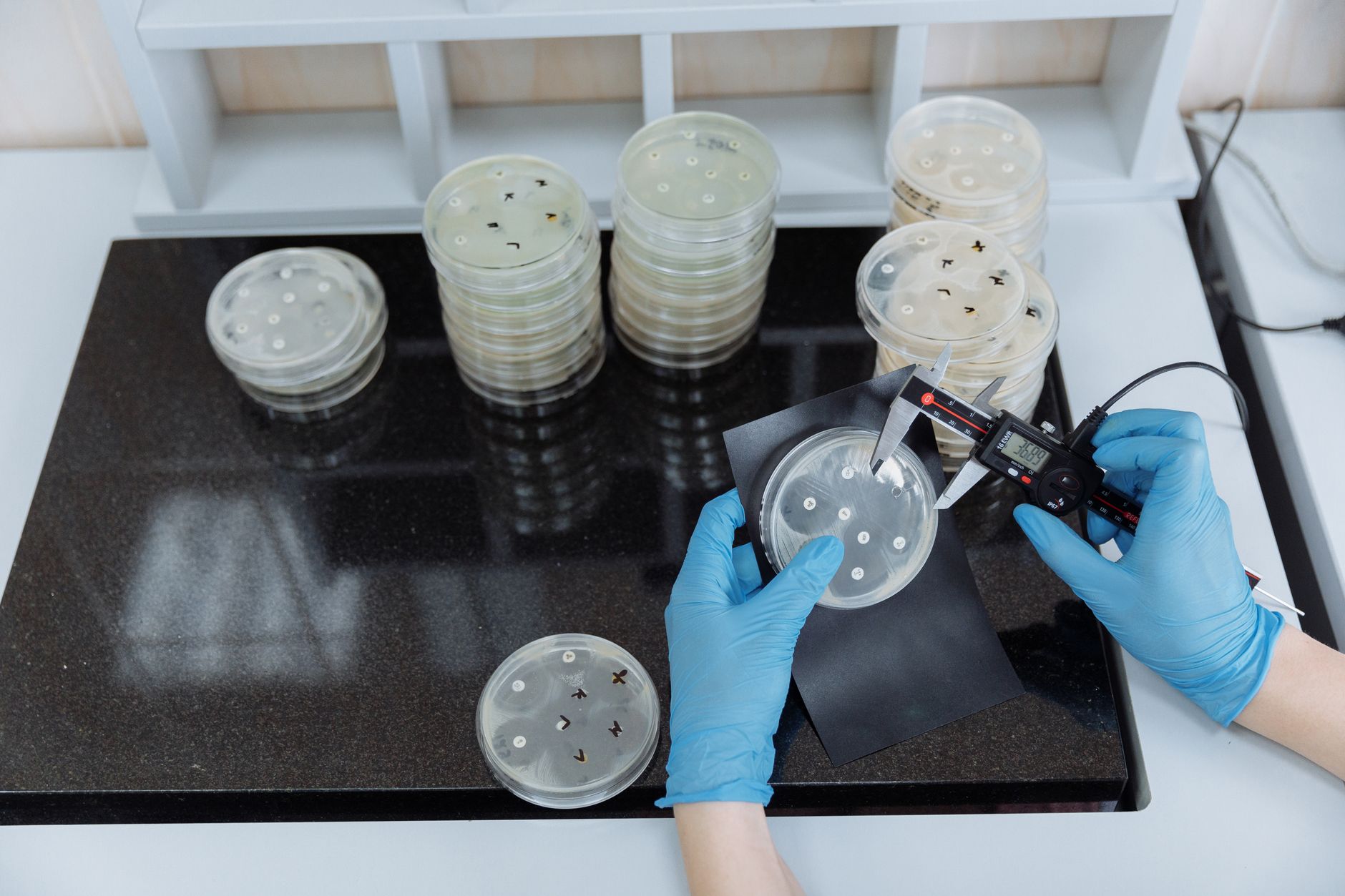 Hands in blue gloves measuring a petri dish in a lab for gut microbiome analysis.