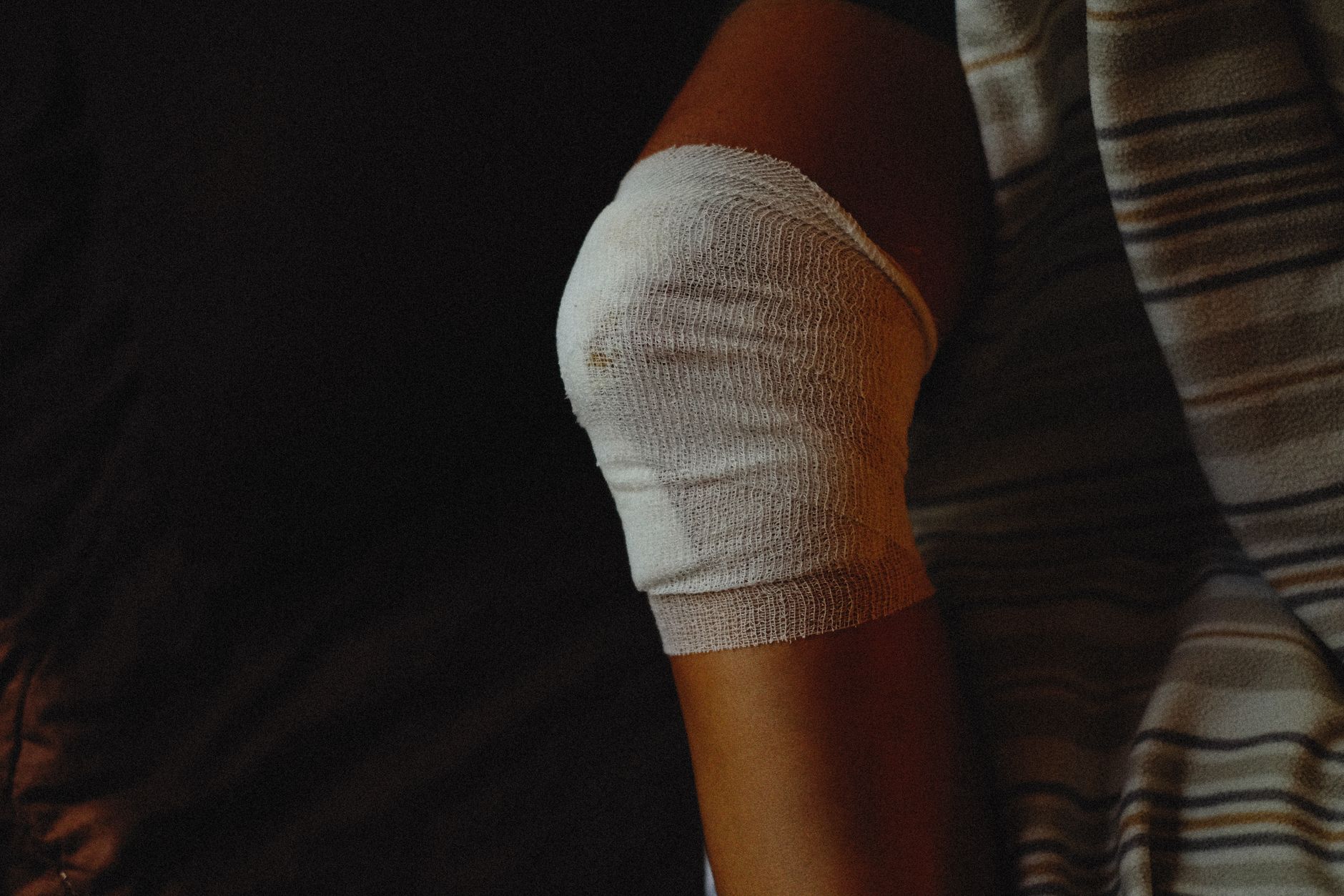 Close-up of a knee wrapped in a compression bandage for lymphedema therapy.