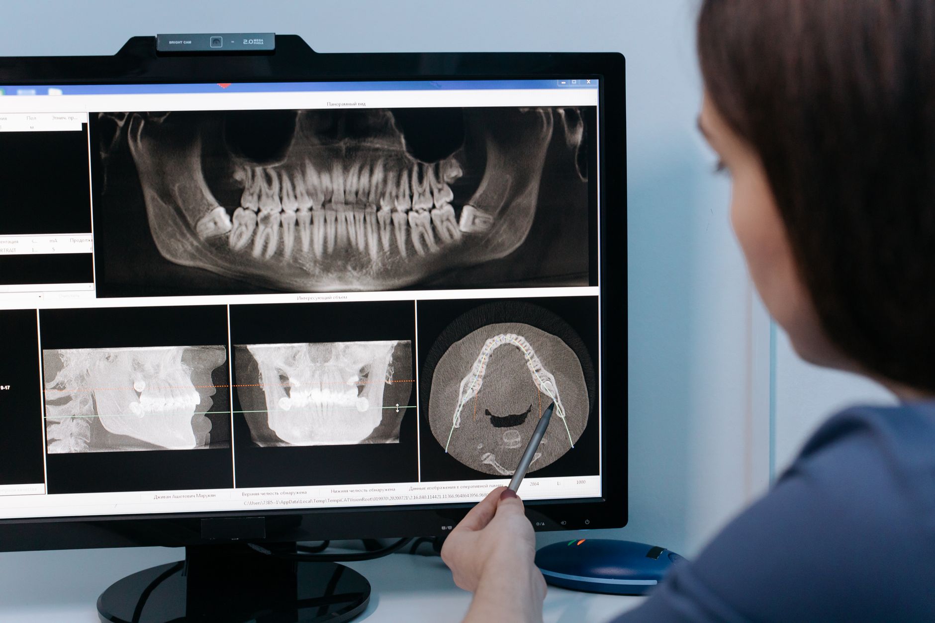 A healthcare professional analyzes dental X-rays on a screen during a consultation.