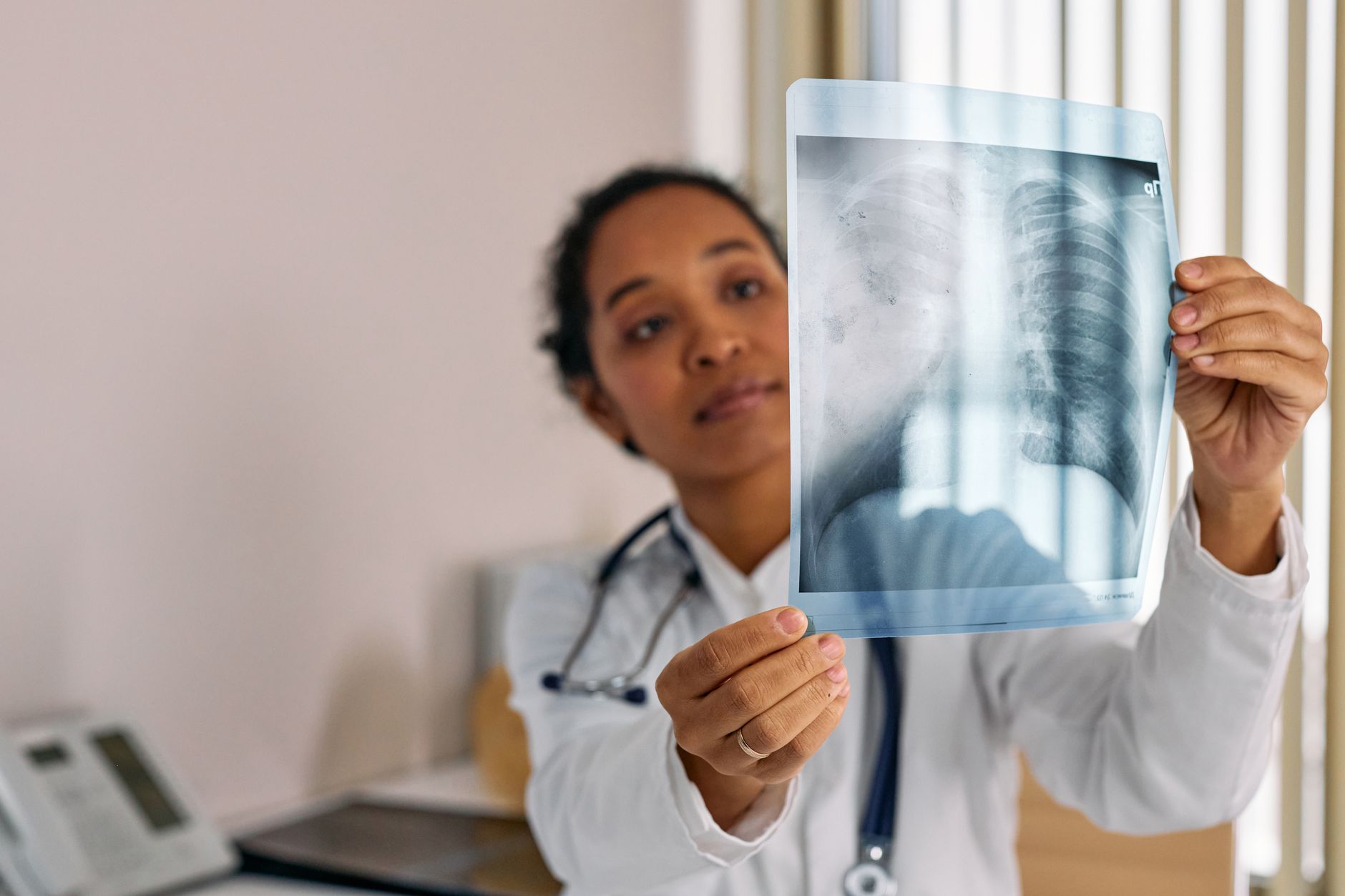 A doctor holds an X-ray image, examining patient's lungs in a Turkish hospital.