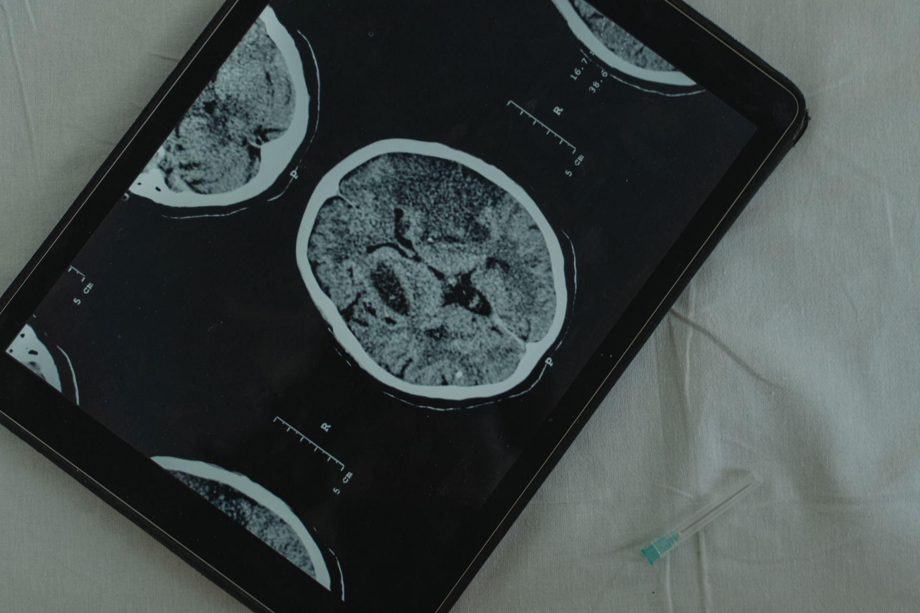 Tablet displaying CT scan images of the brain in a medical environment.