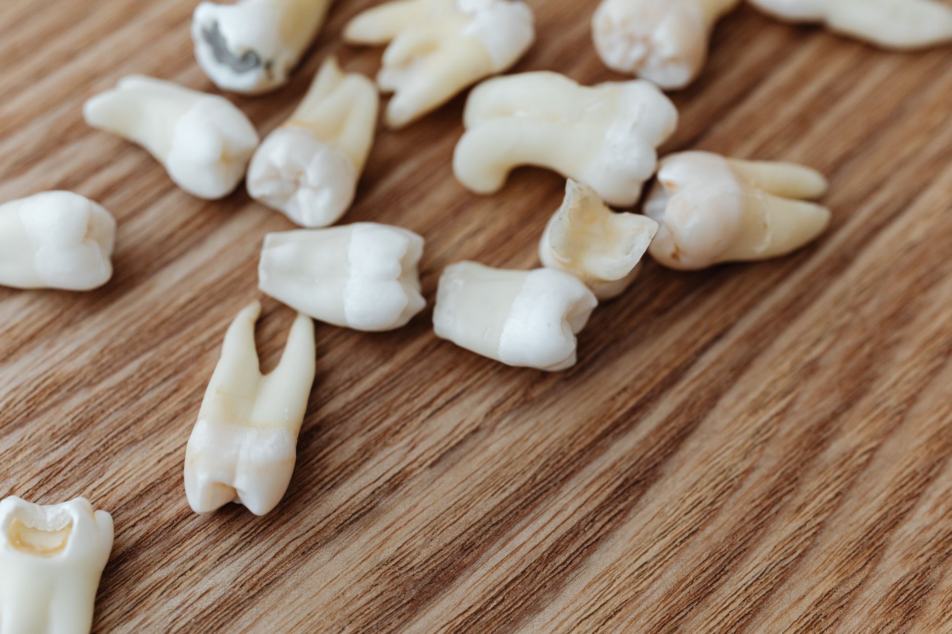 Collection of extracted wisdom teeth on a wooden surface.