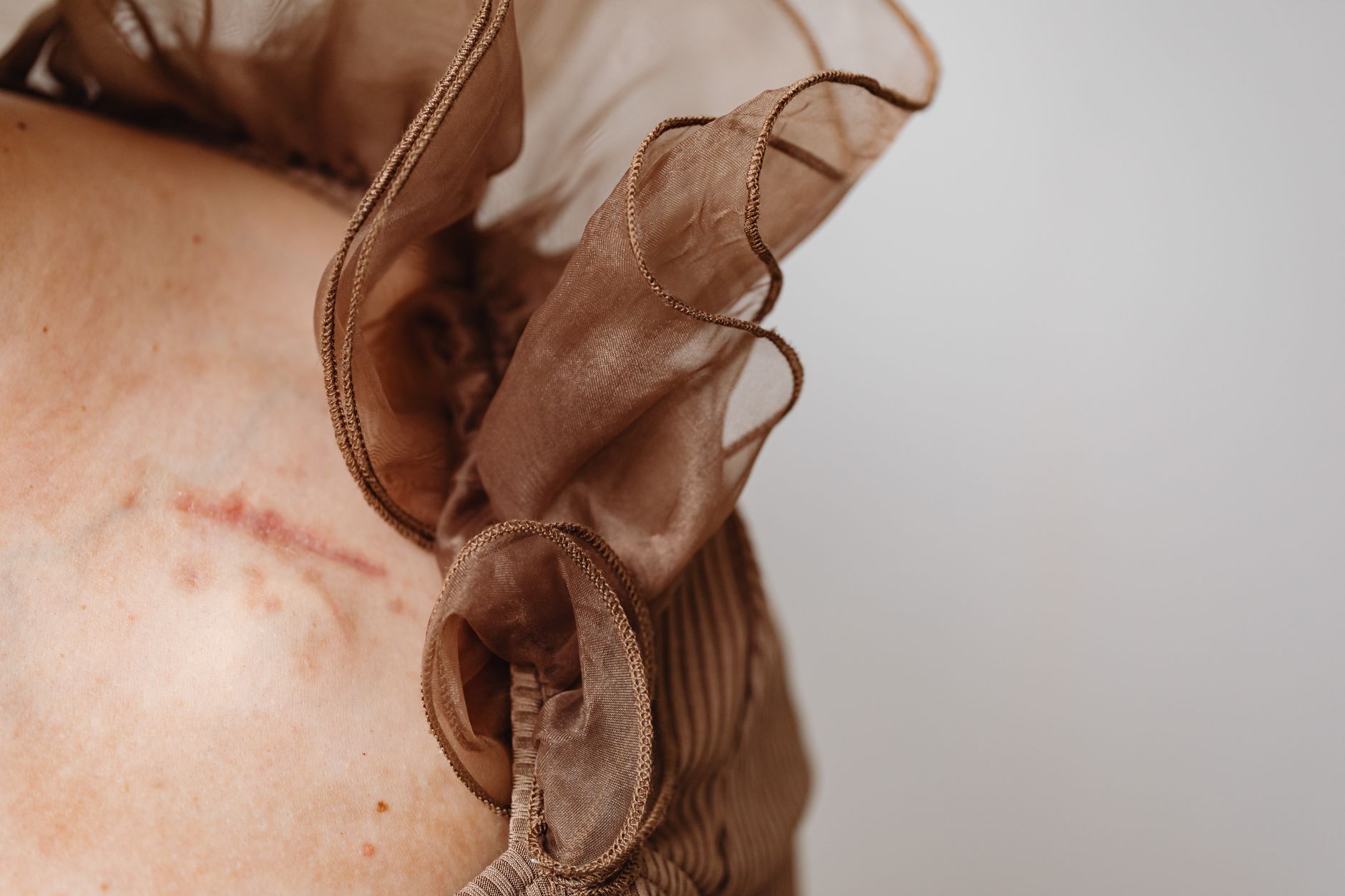 Close-up of skin with surgical scar and soft fabric, symbolizing support after mastectomy.