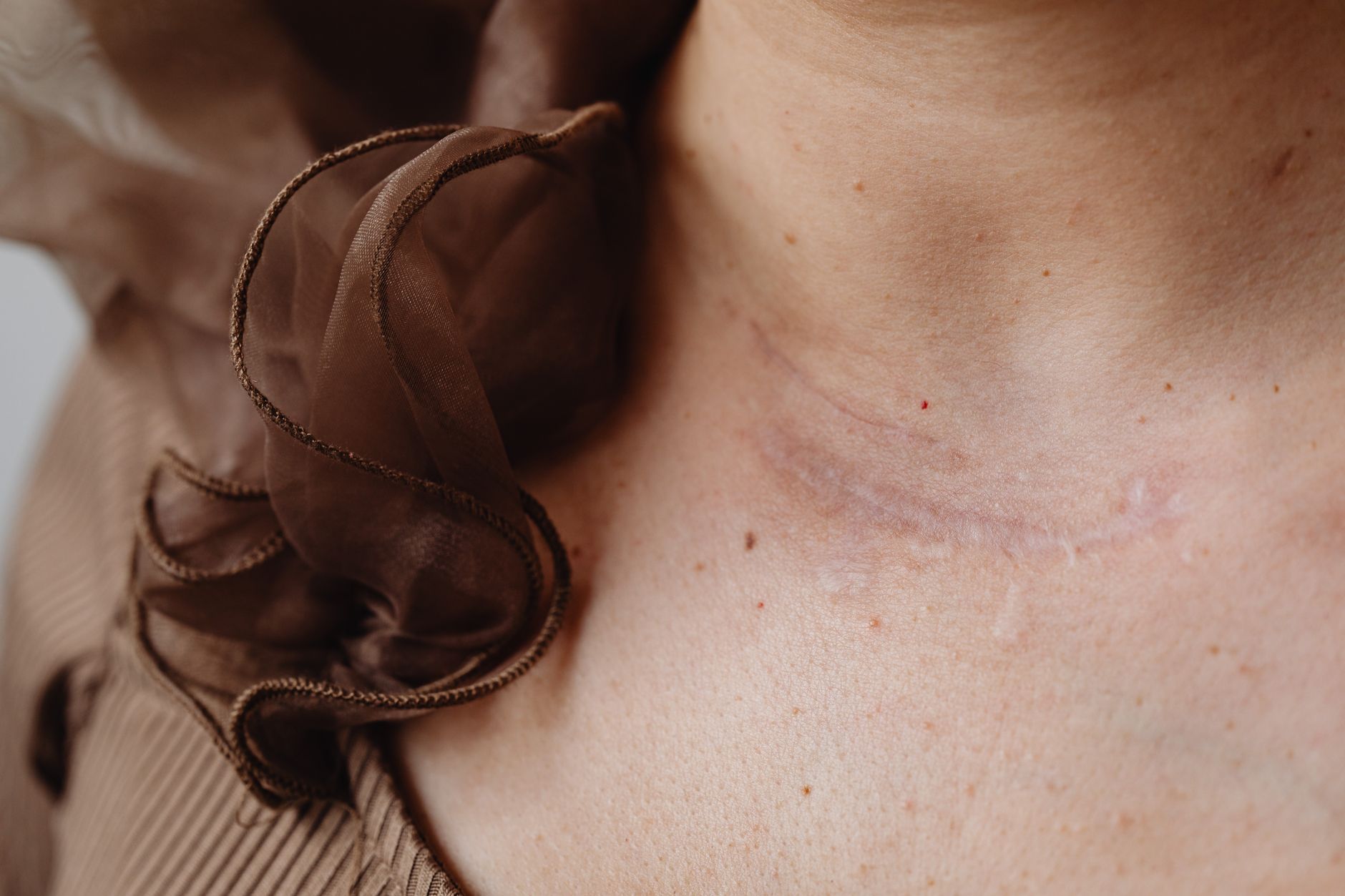 Close-up of silicone gel sheets and scar-care products for effective scar management.