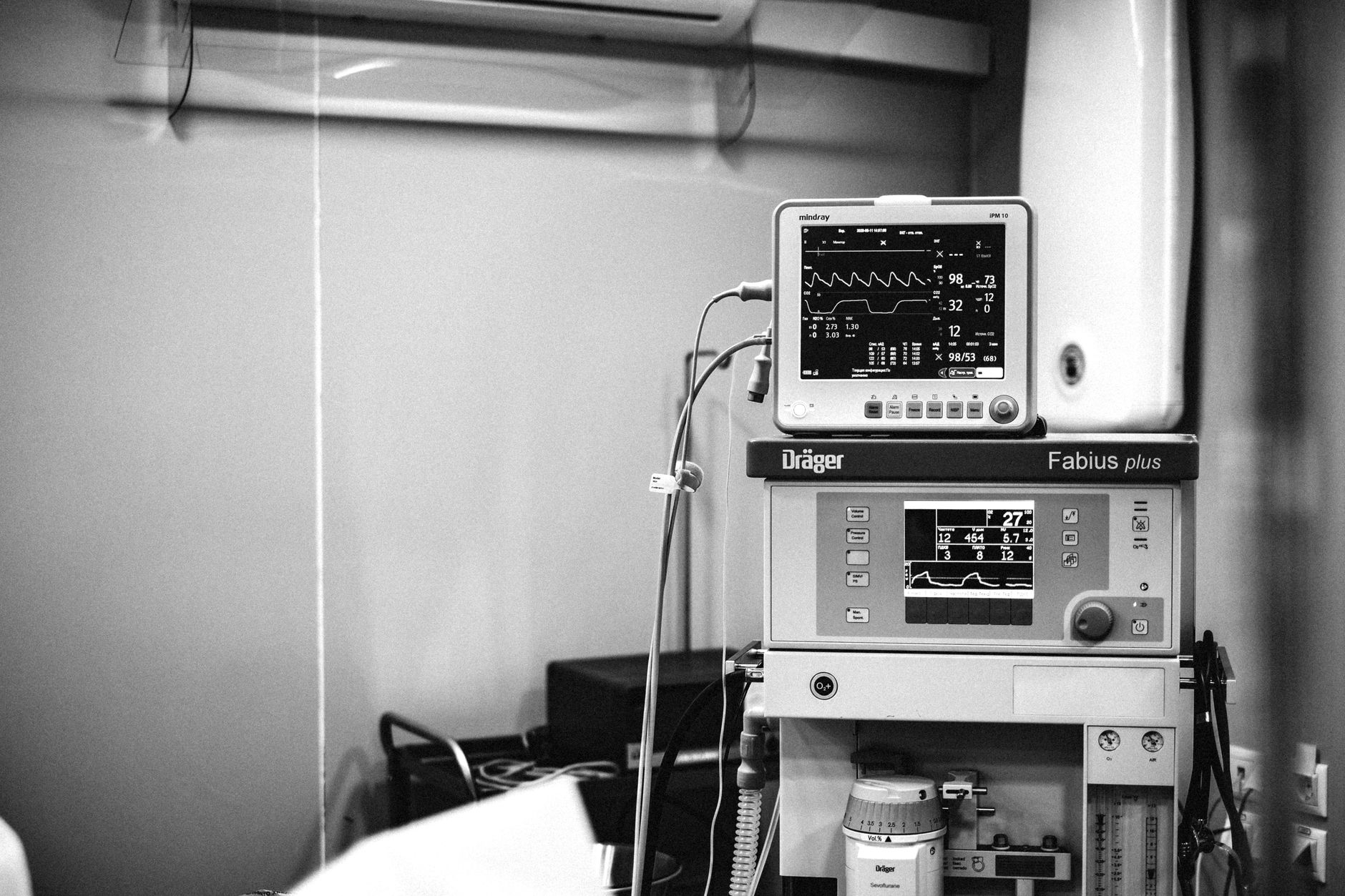 ICU equipment displaying vital signs for post-transplant critical care.