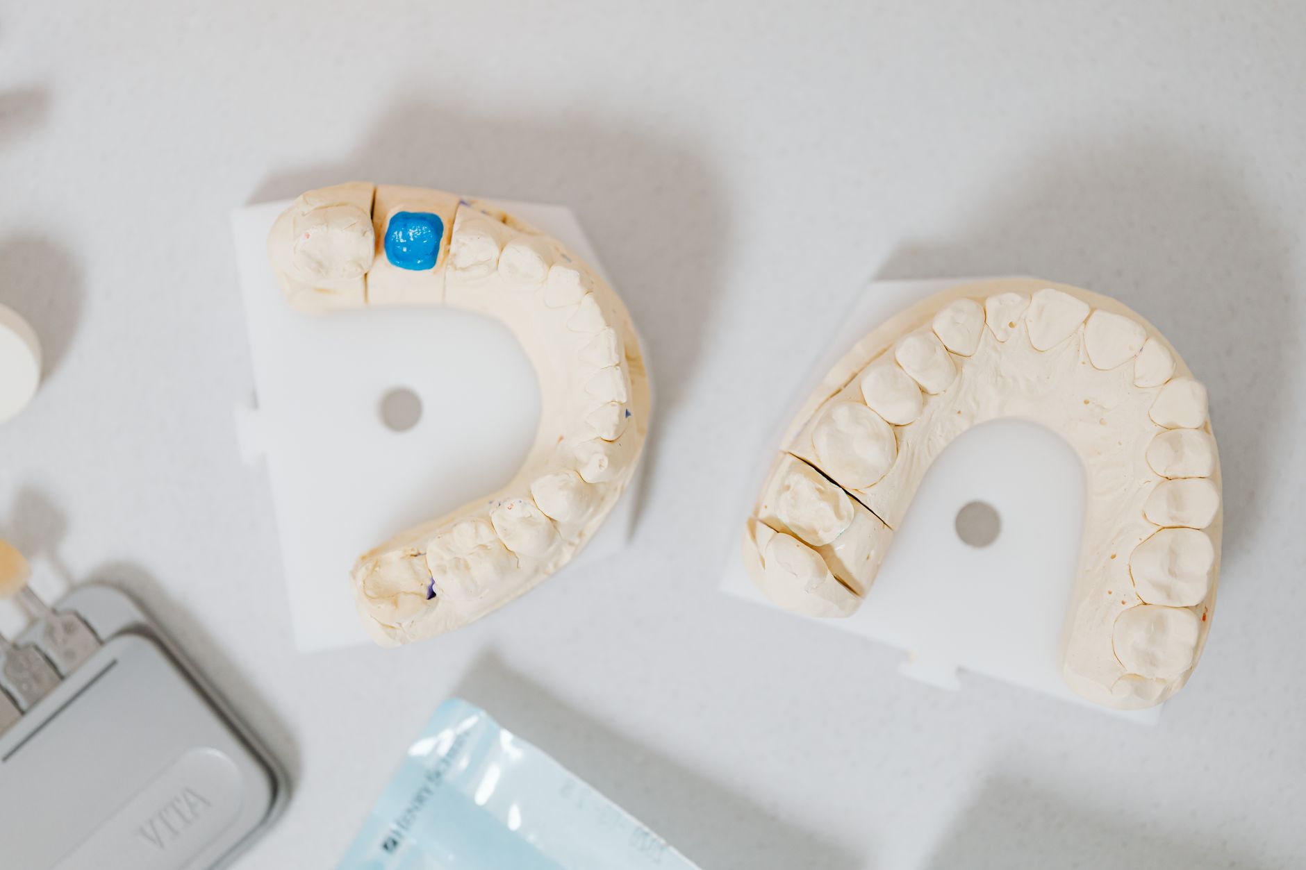 Dental models in a Turkish lab for creating a zirconia crown, showing detailed impressions.