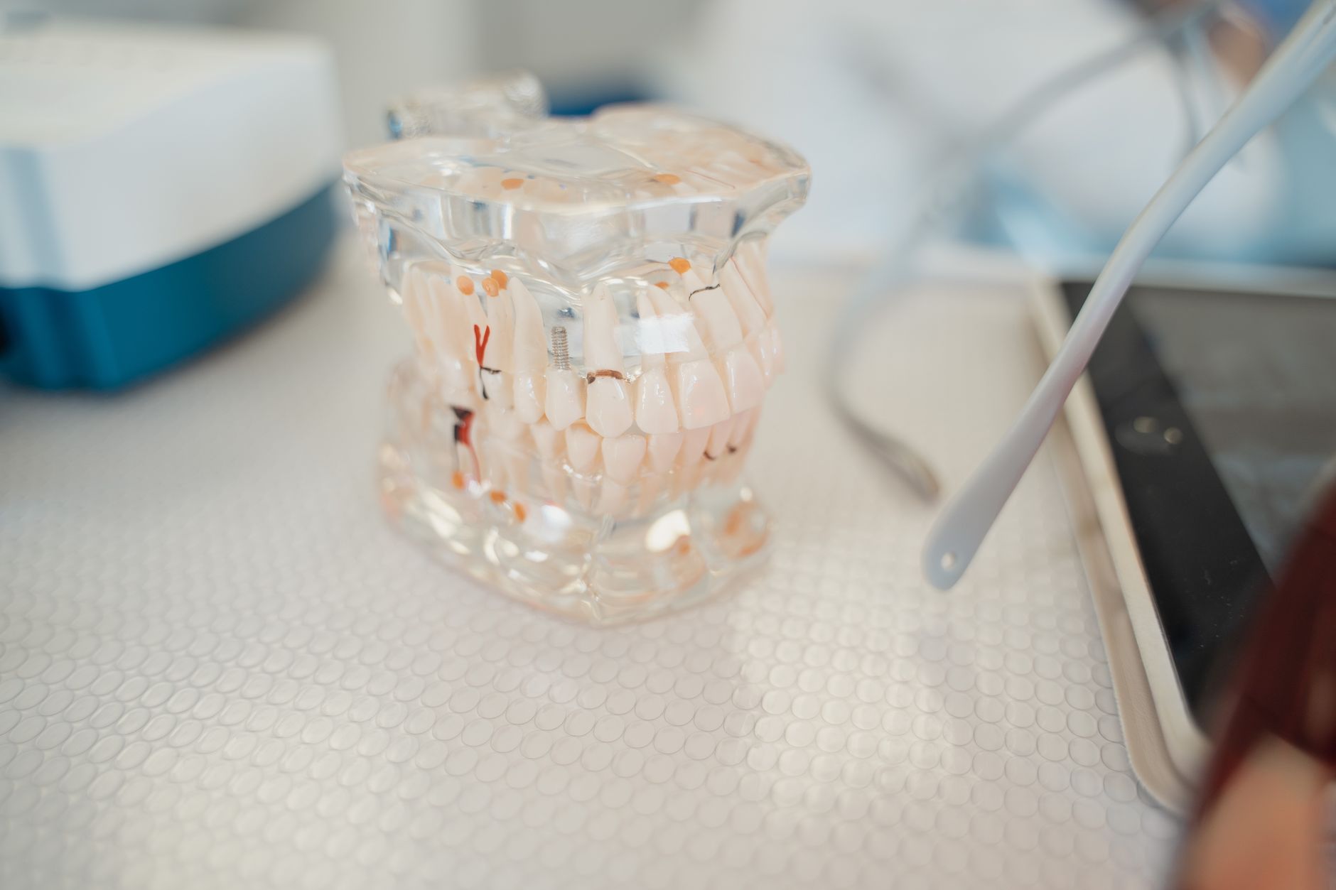 Close-up of a dental implant model showing titanium fixture and prosthesis.