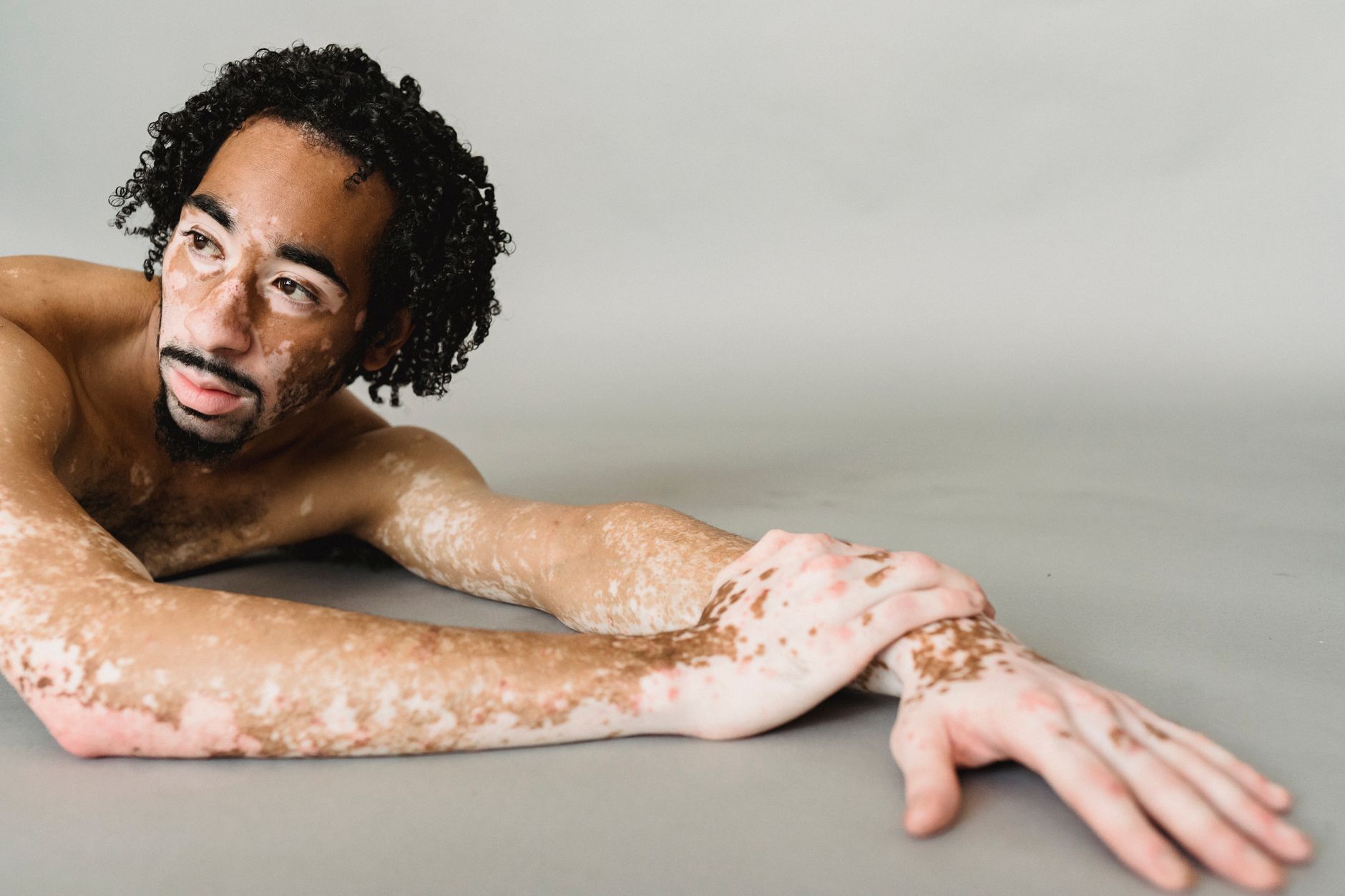 A doctor assesses a patient's skin for vitiligo using a Wood's lamp in a clinical setting.